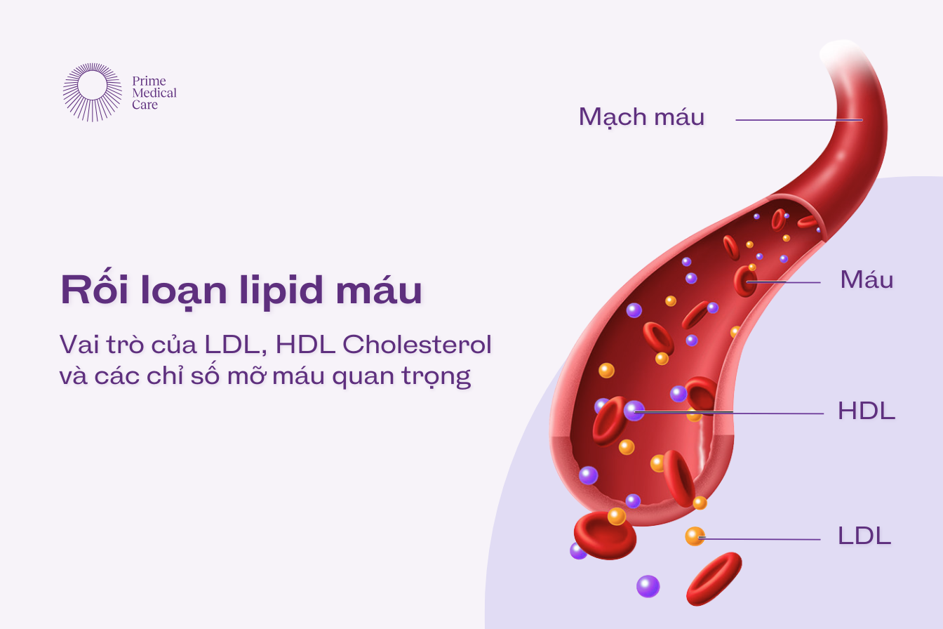 Rối loạn Lipid máu Lipid máu Cholesterol HDL Cholesterol LDL Cholesterol
