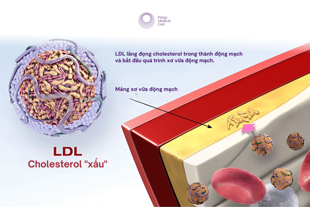 Rối loạn chuyển hoá lipid
Nguyên nhân rối loạn lipid máu
Triệu chứng rối loạn lipid máu
Điều trị rối loạn mỡ máu
Chế độ ăn cho người rối loạn mỡ máu
Bệnh mạch vành do cholesterol cao
Tác hại của LDL cholesterol
HDL cholesterol là gì
Mỡ máu cao có nguy hiểm không
Các yếu tố nguy cơ tăng mỡ máu
Chỉ số mỡ máu bình thường
Tăng triglyceride
Kiểm soát cholesterol máu
Xét nghiệm lipid máu
Thuốc điều trị rối loạn lipid máu
LDL